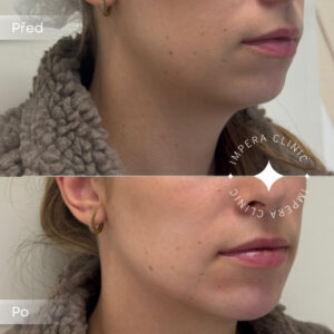 contouring (2)
